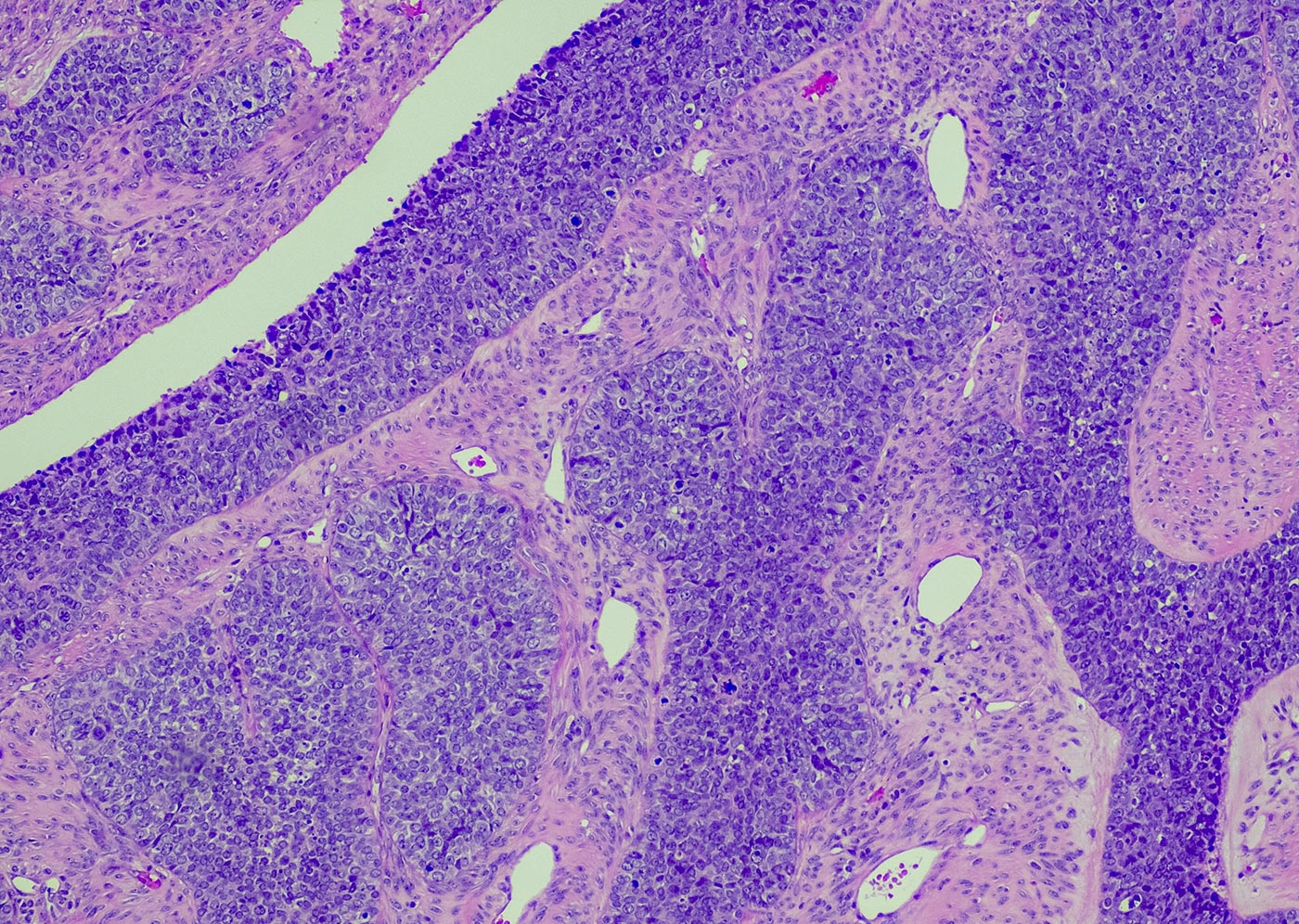Photo of Stratégies d’analyse multiomique du tissu tumoral ovarien à l’aide de l’imagerie pancellulaire™