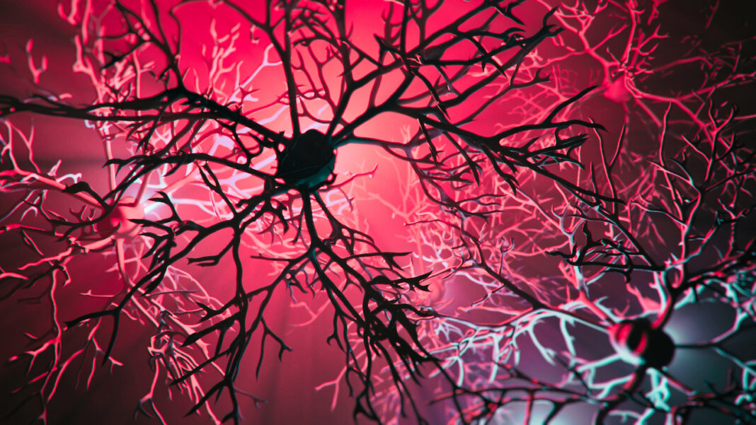 Neuron system disease