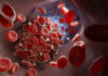 Platelet Pathway More Traveled with Age, Leads to Excessive Clotting