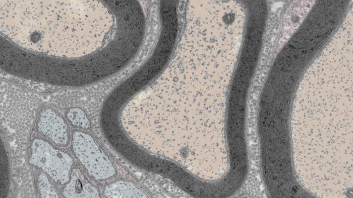Protein That Mediates Repair Function of Nervous System Identified