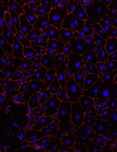 Disease brain endothelial cells stained for tight junction protein, occluding (red) and DAPI (nuclei, blue).