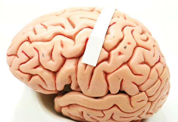 Neural Prosthetic Translates Human Brain Signals into Speech