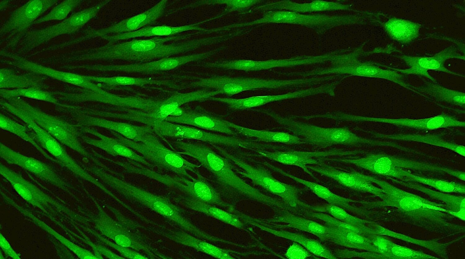 Wound Healing Fibroblast Dance Led by Fascia-Resident Progenitors