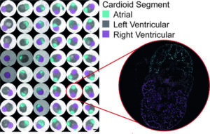 Multi-chambered cardioids can be cultured in high-throughput in different combinations. Close-up shows the cross-section of a multi-chamber cardioid, with the atrial organoid in cyan, the left ventricular organoid in white and the right ventricular organoid in magenta.