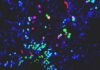 Nanoplastics-Brain Protein Interaction Creates Changes Linked to Parkinson’s Disease