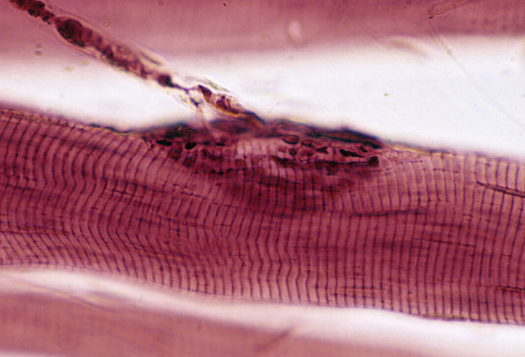 Neuromuscular junction. 250X at 35mm. Shows: a neuromuscular junction (motor end plate), an axon of a motor neuron, and a striated skeletal muscle fiber (cell).