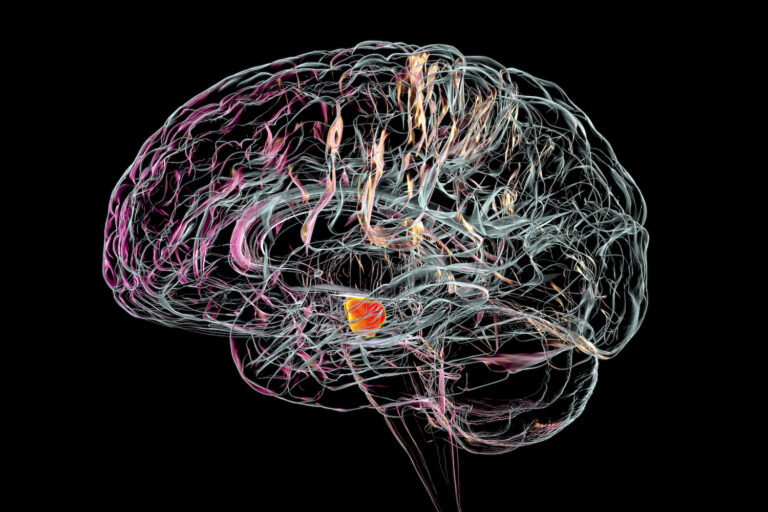 SARS-CoV-2 Infection Can Trigger Dopaminergic Neuron Senescence