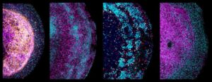 Four zoom-in images of parts of different human fetal brain organoids. Different neural markers are stained, depicting their cellular heterogeneity and architecture.