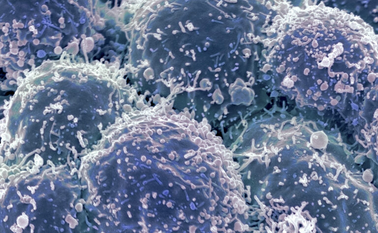 CRISPR-Cas9 Targets Lung Cancer Using Cryo-Shocked Tumor Cells