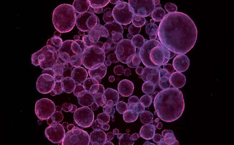 Organoids Stand Out as Stand Ins in Drug Development