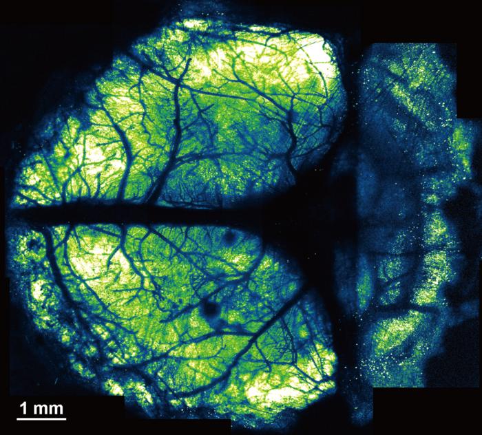 Brain Imaging of Greater Scope Achieved with In Vivo Nanosheet Method