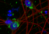 Alzheimer’s Tauopathy Model Uses Human Neurons, Implicates UFMylation