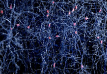 ASO Therapy Repairs Neurons from Timothy Syndrome Patients