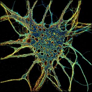 cultured hippocampal neurons
