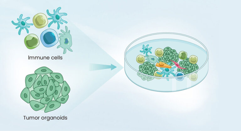 Organoid-Immune Co-Culture Models for Cancer Research