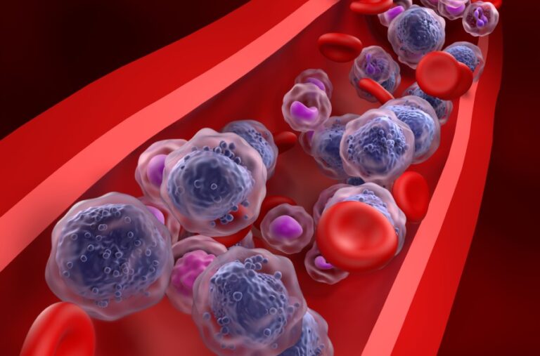 Leukemia Relapse Could Be Prevented by Disrupting Immune Signaling Mechanism