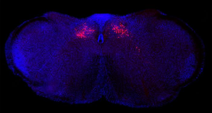 New Brain Circuit Identified in Mice That Controls Body’s Inflammatory Reactions