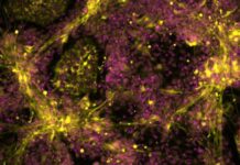 Stem Cell Model Illuminates Genetic Drivers of Neuroblastoma