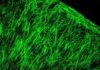 Myelin Sheath Damage Mediated by Epigenetic Remedy in Multiple Sclerosis