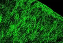 Myelin Sheath Damage Mediated by Epigenetic Remedy in Multiple Sclerosis