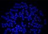 Telomere Stability Study Finds New Wrinkle in DNA Repair, Could Inform Anticancer Research