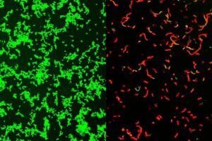 Researchers at Washington University School of Medicine in St. Louis have developed a compound that is effective against common bacteria that can lead to rare, dangerous illnesses. This image shows untreated Streptococcus pyogenes bacterial culture full of healthy microbes, labeled green (left). After treatment by GmPcide, the dish is full of dead bacteria (red; right). [Zongsen Zou, Ph.D, Washington University in St Louis.]