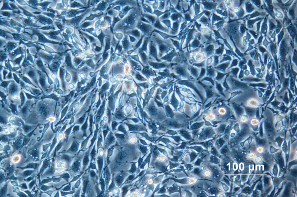 cho cells