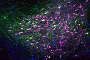 Brain cells (magenta) in the reward center of a rat’s brain release dopamine in response to opioids. According to a new study by WashU Medicine researchers, male and female rats with a chronic pain condition release different amounts of dopamine when given fentanyl because of sex hormones. The findings might help explain why men have higher rates of opioid use and overdose deaths.[Jessica Higginbotham/WashU Medicine]