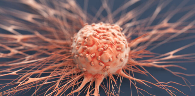 Human Cancer Cell