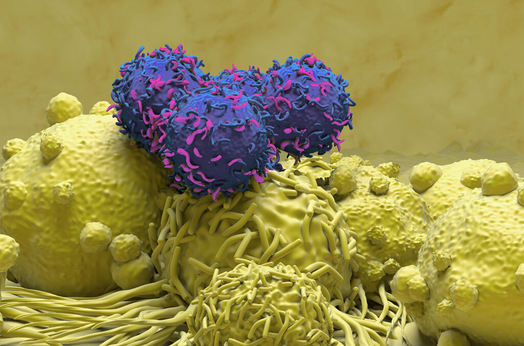 CAR-T cell therapy for kidney cancer