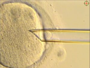 mitochondrial transfer