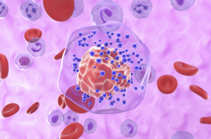 triple negative breast cancer