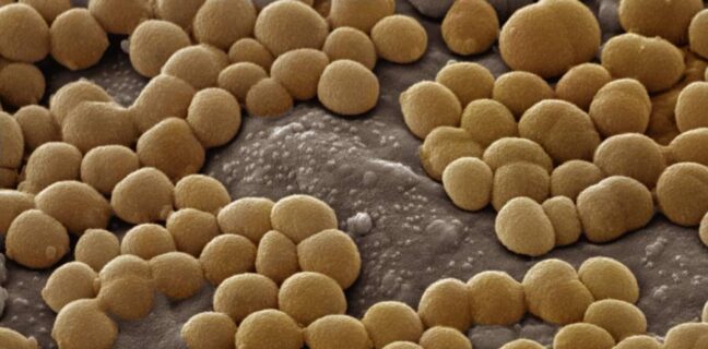 A Scanning Electron Micrograph (SEM): Staphylococcus aureus; Magnification 38,000.