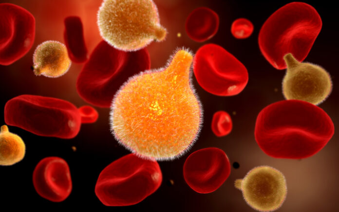 Getty_476872691_PlasmodiumCausingMalaria Malaria