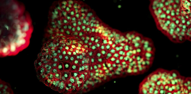 organoids
