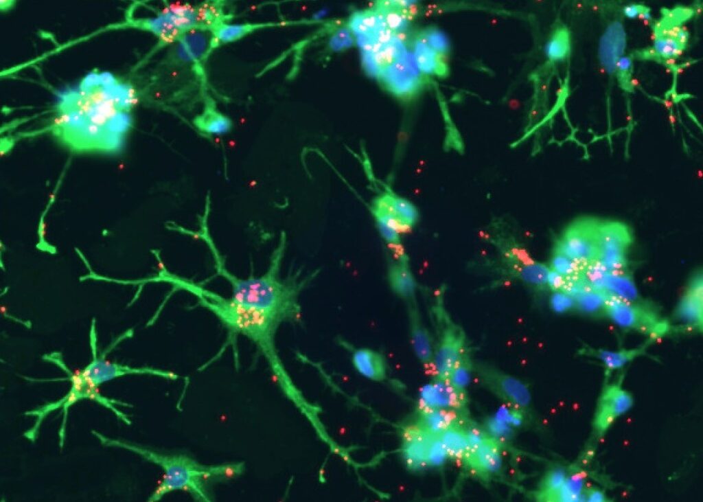 microglial immune cells