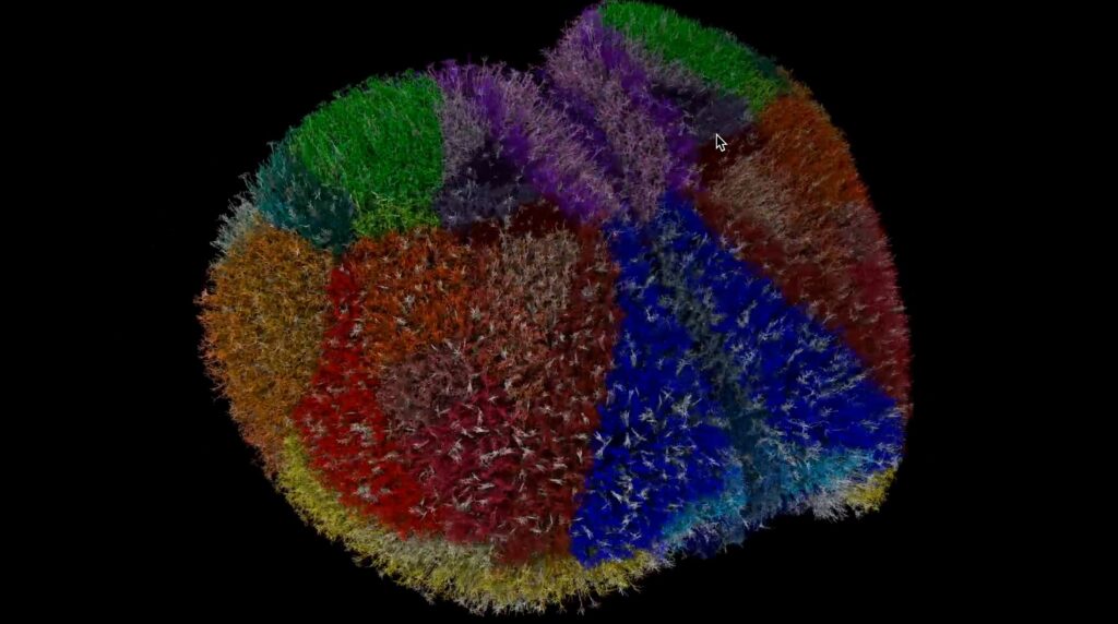 Brain simulation