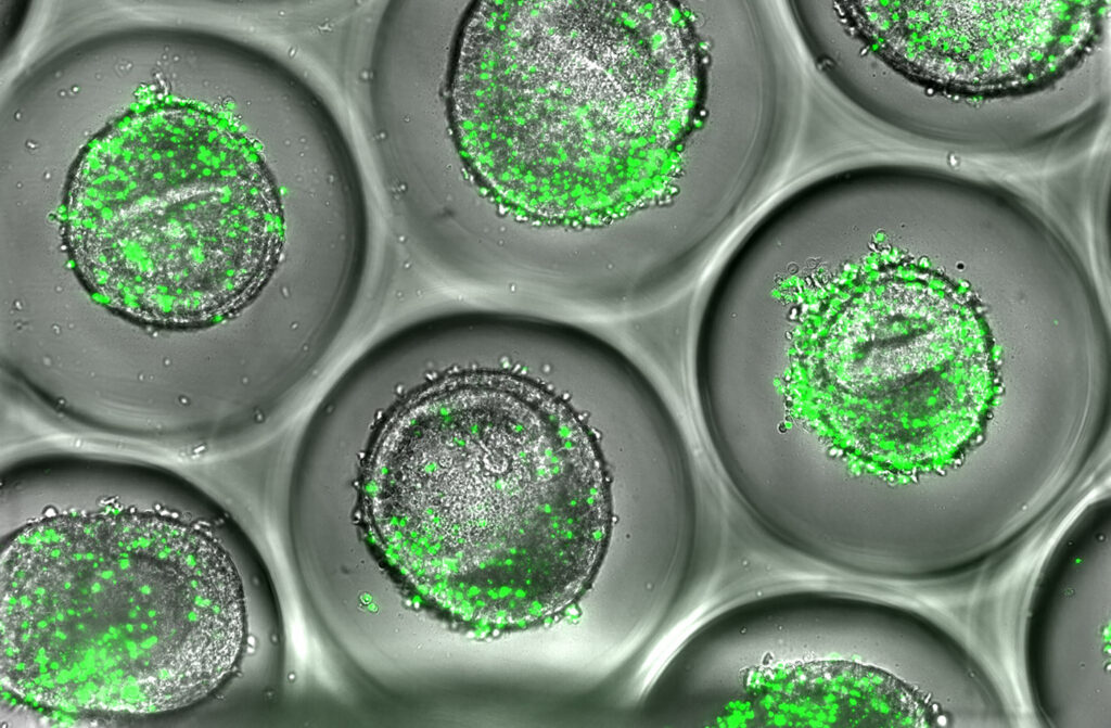 Liver Organoids