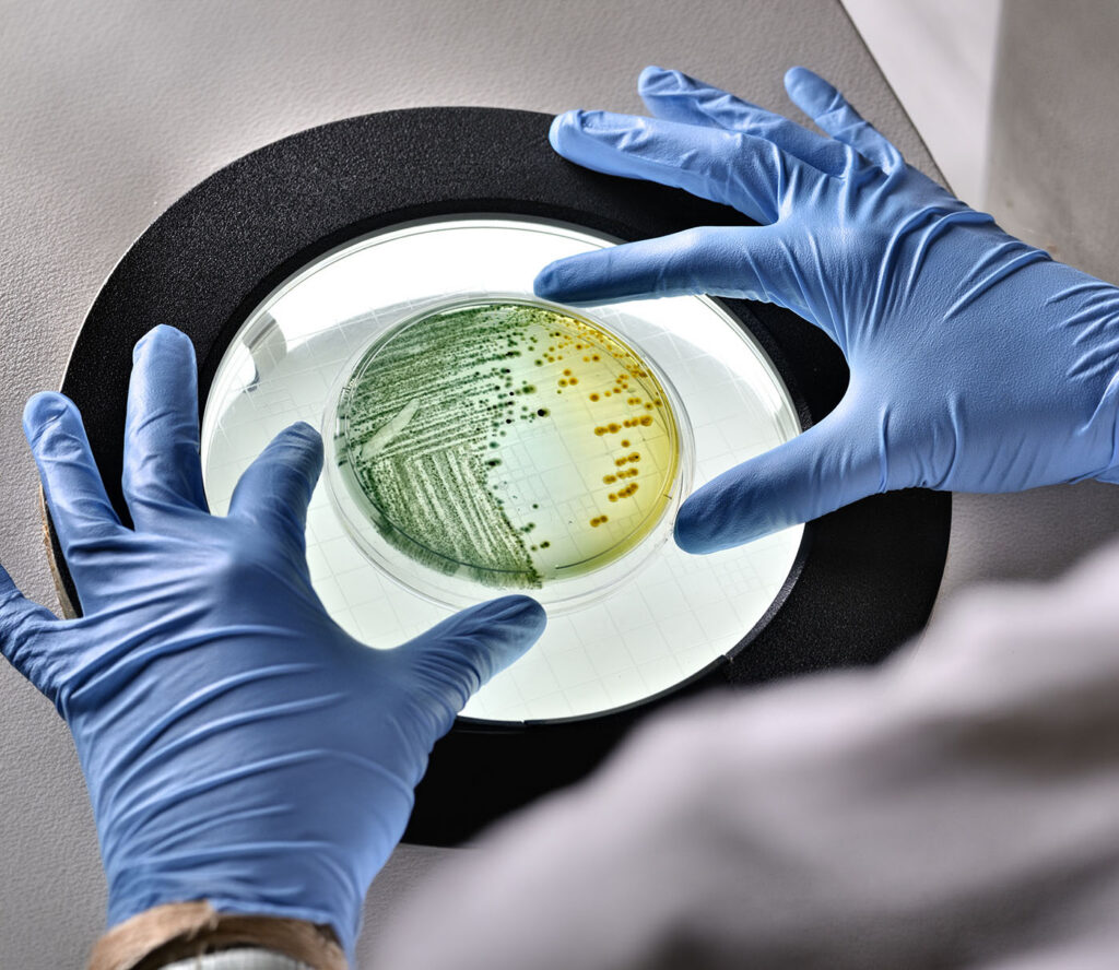 E.coli bacteria growing in dish inspected