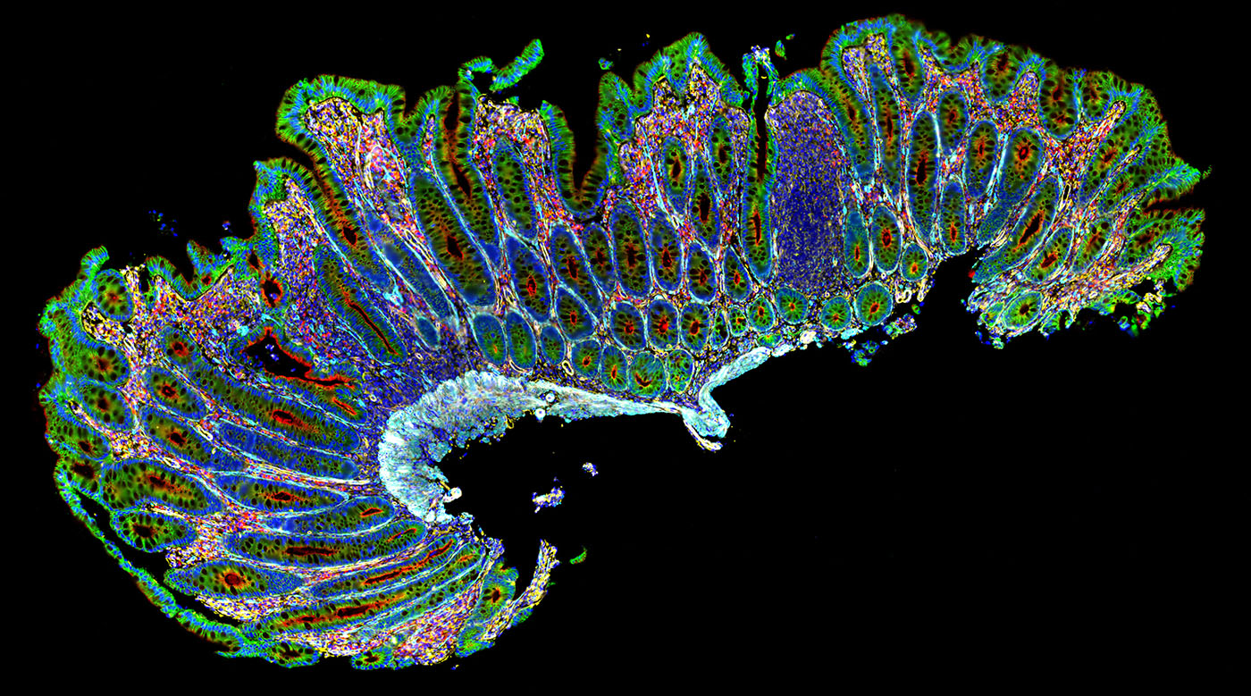 Bruker’s CellScape XR Targets Scalable Multiplexed Immunofluorescence Imaging