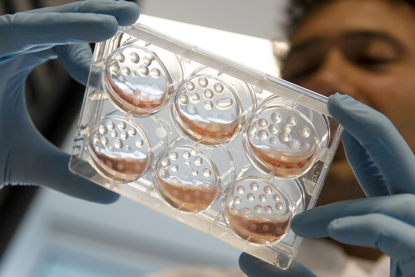 Organoids as Predictive Translational Models for Drug Development