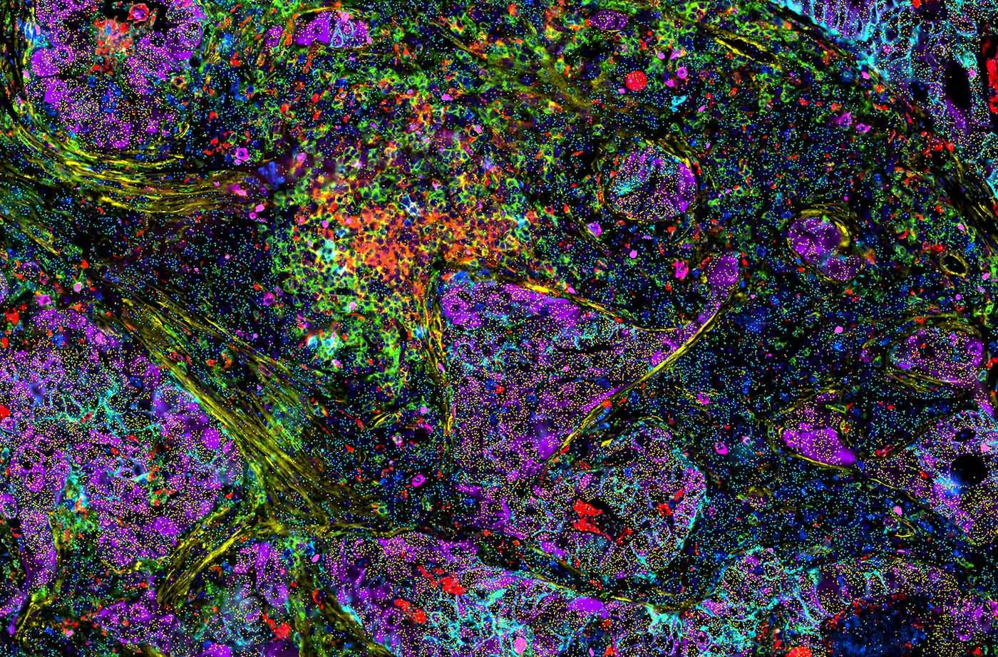 Investigating the Dynamics  of the Tumor Microenvironment