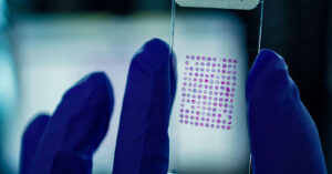 blue gloved hand holding slide