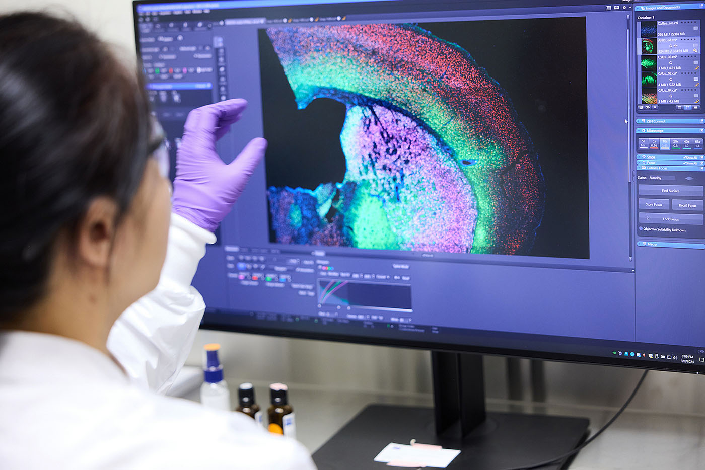 Gene Editing at Scale, Clinic Seeks Generalizable Therapies