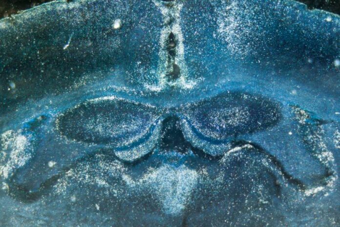 An image showing rat brain hippocampal neurons [defun].