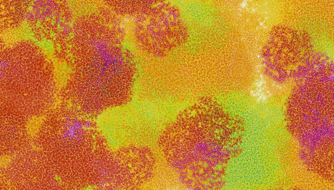 Overcoming the VLP Purification Bottleneck