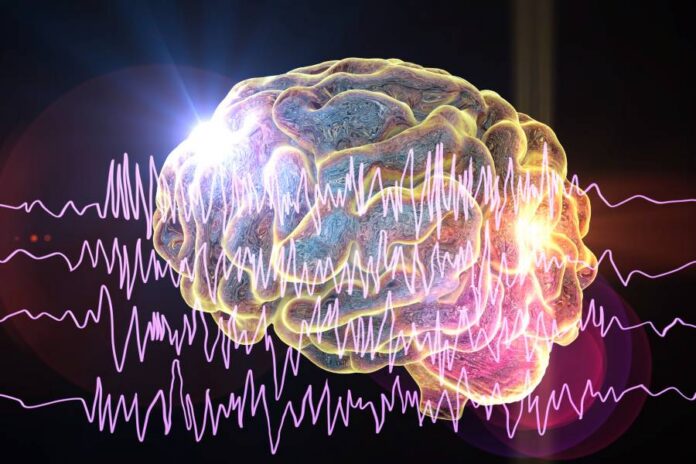 A illustration of the brain and brain waves in epilepsy.