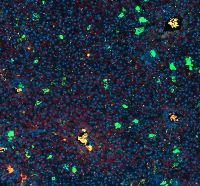 Anticancer Strategy Targets Defense Mechanism in Senescent Cells