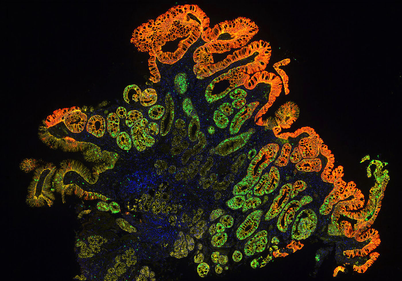 Spatial Biology