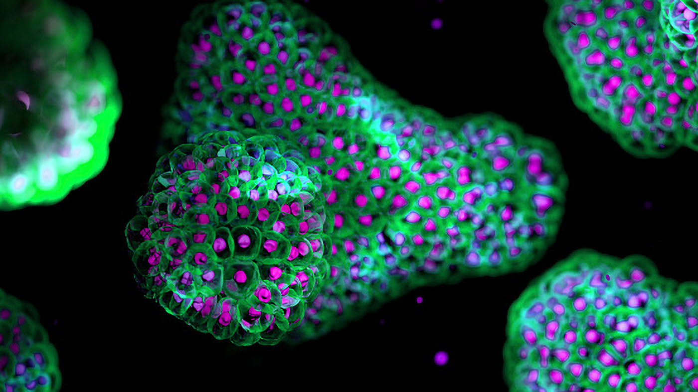 Organoids Drive Human-Relevant Drug Discovery